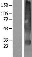 SLC22A18 Protein - Western validation with an anti-DDK antibody * L: Control HEK293 lysate R: Over-expression lysate