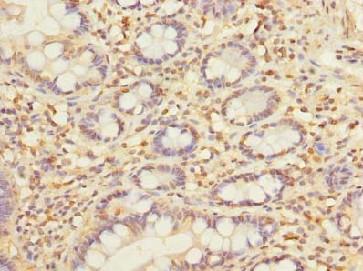 SLC22A18AS Antibody - Immunohistochemistry of paraffin-embedded human small intestine tissue using antibody at dilution of 1:100.