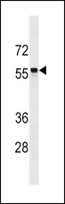 SLC22A2 Antibody - SLC22A2 Antibody western blot of CEM cell line lysates (35 ug/lane). The SLC22A2 antibody detected the SLC22A2 protein (arrow).