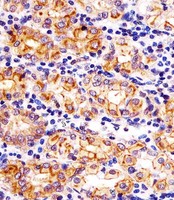 SLC22A2 Antibody - Antibody staining SLC22A2 in human stomach tissue sections by Immunohistochemistry (IHC-P - paraformaldehyde-fixed, paraffin-embedded sections). Tissue was fixed with formaldehyde and blocked with 3% BSA for 0. 5 hour at room temperature; antigen retrieval was by heat mediation with a citrate buffer (pH 6). Samples were incubated with primary antibody (1:25) for 1 hours at 37°C. A undiluted biotinylated goat polyvalent antibody was used as the secondary antibody.