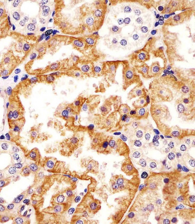 SLC22A2 Antibody - Antibody staining SLC22A2 in human kidney tissue sections by Immunohistochemistry (IHC-P - paraformaldehyde-fixed, paraffin-embedded sections). Tissue was fixed with formaldehyde and blocked with 3% BSA for 0. 5 hour at room temperature; antigen retrieval was by heat mediation with a citrate buffer (pH 6). Samples were incubated with primary antibody (1/25) for 1 hours at 37°C. A undiluted biotinylated goat polyvalent antibody was used as the secondary antibody.