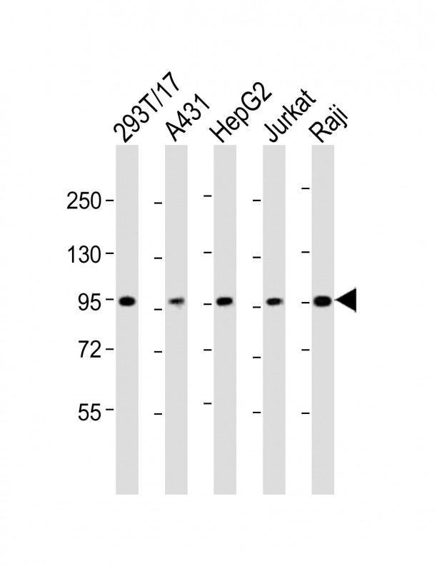 SLC22A2 Antibody - All lanes: Anti-SLC22A2 Antibody (N-term) at 1:2000 dilution. Lane 1: 293T/17 whole cell lysate. Lane 2: A431 whole cell lysate. Lane 3: HepG2 whole cell lysate. Lane 4: Jurkat whole cell lysate. Lane 5: Raji whole cell lysate Lysates/proteins at 20 ug per lane. Secondary Goat Anti-Rabbit IgG, (H+L), Peroxidase conjugated at 1:10000 dilution. Predicted band size: 63 kDa. Blocking/Dilution buffer: 5% NFDM/TBST.