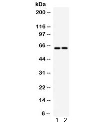 SLC22A2 Antibody - Western blot testing of 1) rat brain and 2) mouse brain lysate with SLC22A2 antibody. Expected/observed molecular weight 63 kDa.