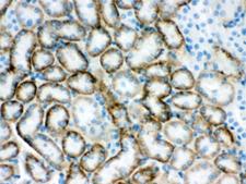 SLC22A2 Antibody - IHC testing of FFPE mouse kidney with SLC22A2 antibody. HIER: Boil the paraffin sections in pH 6, 10mM citrate buffer for 20 minutes and allow to cool prior to staining.