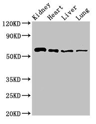 SLC22A2 Antibody - Western Blot Positive WB detected in: Mouse kidney tissue, Rat heart tissue, Rat liver tissue, Rat lung tissue All lanes: SLC22A2 antibody at 2.7µg/ml Secondary Goat polyclonal to rabbit IgG at 1/50000 dilution Predicted band size: 63, 55, 27 kDa Observed band size: 63 kDa