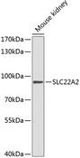 SLC22A2 Antibody - Western blot analysis of extracts of mouse kidney using SLC22A2 Polyclonal Antibody at dilution of 1:1000.