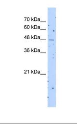 SLC22A23 Antibody - Jurkat cell lysate. Antibody concentration: 5.0 ug/ml. Gel concentration: 12%.  This image was taken for the unconjugated form of this product. Other forms have not been tested.