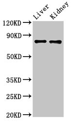 SLC22A23 Antibody - Positive Western Blot detected in Mouse liver tissue, Mouse kidney tissue. All lanes: SLC22A23 antibody at 5.2 µg/ml Secondary Goat polyclonal to rabbit IgG at 1/50000 dilution. Predicted band size: 74, 45, 35, 39 KDa. Observed band size: 74 KDa