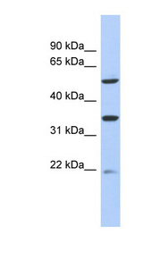 SLC22A24 Antibody - SLC22A24 antibody Western blot of 293T cell lysate. This image was taken for the unconjugated form of this product. Other forms have not been tested.