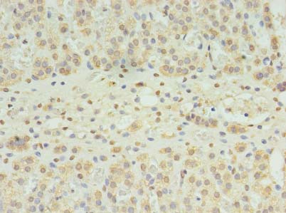 SLC22A24 Antibody - Immunohistochemistry of paraffin-embedded human adrenal gland tissue using antibody at dilution of 1:100.