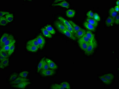 SLC22A25 Antibody - Immunofluorescence staining of HepG2 cells with SLC22A25 Antibody at 1:100, counter-stained with DAPI. The cells were fixed in 4% formaldehyde, permeabilized using 0.2% Triton X-100 and blocked in 10% normal Goat Serum. The cells were then incubated with the antibody overnight at 4°C. The secondary antibody was Alexa Fluor 488-congugated AffiniPure Goat Anti-Rabbit IgG(H+L).