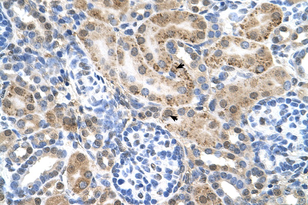SLC22A3 / OCT3 Antibody - SLC22A3 antibody ARP44026_P050-NP_068812-SLC22A3(solute carrier family 22 (extraneuronal monoamine transporter), member 3) Antibody IHC of formalin-fixed, paraffin-embedded human Kidney. Positive label: Epithelial cells of renal tubule indicated with arrows. Antibody concentration 4-8 ug/ml. Magnification 400X.  This image was taken for the unconjugated form of this product. Other forms have not been tested.