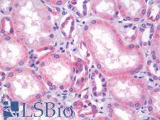 SLC22A3 / OCT3 Antibody - Human Kidney: Formalin-Fixed, Paraffin-Embedded (FFPE)