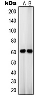 SLC22A3 / OCT3 Antibody - Western blot analysis of OCT3 expression in HT29 (A); JAR (B) whole cell lysates.