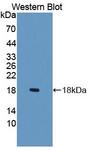 SLC22A4 / OCTN1 Antibody - Western blot of SLC22A4 / OCTN1 antibody.
