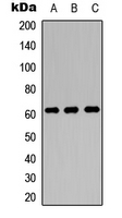 SLC22A4 / OCTN1 Antibody - Western blot analysis of OCTN1 expression in MCF7 (A); NS-1 (B); PC12 (C) whole cell lysates.