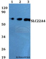 SLC22A4 / OCTN1 Antibody - Western blot of SLC22A4 antibody at 1:500 dilution. Lane 1: MCF-7 whole cell lysate. Lane 2: sp2/0 whole cell lysate. Lane 3: PC12 whole cell lysate.