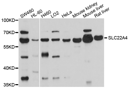 SLC22A4 / OCTN1 Antibody - Western blot analysis of extracts of various cell lines, using SLC22A4 antibody at 1:1000 dilution. The secondary antibody used was an HRP Goat Anti-Rabbit IgG (H+L) at 1:10000 dilution. Lysates were loaded 25ug per lane and 3% nonfat dry milk in TBST was used for blocking. An ECL Kit was used for detection and the exposure time was 10s.