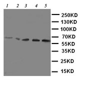 SLC22A5 / OCTN2 Antibody - WB of SLC22A5 / OCTN2 antibody. Lane 1: Rat Kidney Tissue Lysate. Lane 2: Rat Skeletal Muscles Tissue Lysate. Lane 3: Mouse Liver Tissue Lysate. Lane 4: HEPA Cell Lysate. Lane 5: NIH3T3 Cell Lysate.