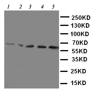 SLC22A5 / OCTN2 Antibody - WB of SLC22A5 / OCTN2 antibody. Lane 1: Rat Kidney Tissue Lysate. Lane 2: Rat Skeletal Muscles Tissue Lysate. Lane 3: Mouse Liver Tissue Lysate. Lane 4: HEPA Cell Lysate. Lane 5: NIH3T3 Cell Lysate.