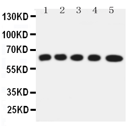 SLC22A5 / OCTN2 Antibody - Anti-Solute carrier family 22 member 5 antibody, Western blotting Lane 1: Rat Kidney Tissue LysateLane 2: Rat Skeletal Muscles Tissue LysateLane 3: Mouse Liver Tissue LysateLane 4: HEPA Cell LysateLane 5: NIH3T3 Cell Lysate