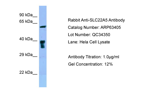 SLC22A5 / OCTN2 Antibody -  This image was taken for the unconjugated form of this product. Other forms have not been tested.
