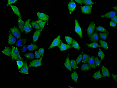 SLC22A5 / OCTN2 Antibody - Immunofluorescence staining of Hela cells diluted at 1:33, counter-stained with DAPI. The cells were fixed in 4% formaldehyde, permeabilized using 0.2% Triton X-100 and blocked in 10% normal Goat Serum. The cells were then incubated with the antibody overnight at 4°C.The Secondary antibody was Alexa Fluor 488-congugated AffiniPure Goat Anti-Rabbit IgG (H+L).