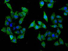 SLC22A5 / OCTN2 Antibody - Immunofluorescence staining of Hela cells diluted at 1:33, counter-stained with DAPI. The cells were fixed in 4% formaldehyde, permeabilized using 0.2% Triton X-100 and blocked in 10% normal Goat Serum. The cells were then incubated with the antibody overnight at 4°C.The Secondary antibody was Alexa Fluor 488-congugated AffiniPure Goat Anti-Rabbit IgG (H+L).