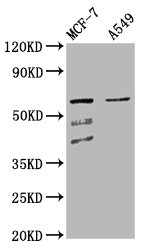 SLC22A5 / OCTN2 Antibody - Western Blot Positive WB detected in: MCF-7 whole cell lysate, A549 whole cell lysate All Lanes: SLC22A5 antibody at 4.3µg/ml Secondary Goat polyclonal to rabbit IgG at 1/50000 dilution Predicted band size: 63, 25, 66 KDa Observed band size: 63 KDa