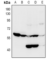 SLC22A5 / OCTN2 Antibody - Western blot analysis of OCTN2 expression in mouse kidney (A), rat kidney (B), HEK293T (C), K562 (D), Hela (E) whole cell lysates.