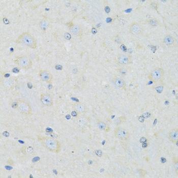 SLC22A5 / OCTN2 Antibody - Immunohistochemistry of paraffin-embedded Mouse brain using SLC22A5 Polyclonal Antibody at dilution of 1:100 (40x lens).