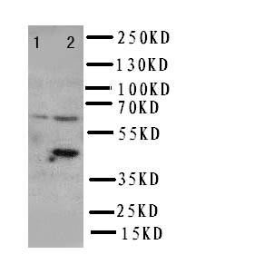 SLC22A6 / OAT1 Antibody - WB of SLC22A6 / OAT1 antibody. Lane 1: HT1080 Cell Lysate. Lane 2: HELA Cell Lysate.