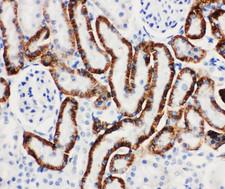 SLC22A6 / OAT1 Antibody - SLC22A6 / OAT1 antibody. IHC(P): Rat Kidney Tissue.