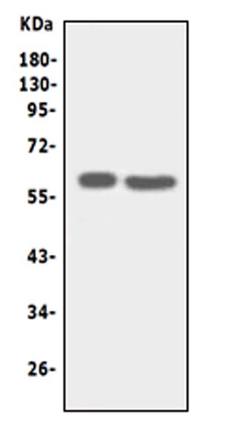 SLC22A6 / OAT1 Antibody - Anti-SLC22A6 antibody, Western blotting Lane 1: HT1080 Cell Lysate Lane 2: HELA Cell Lysate