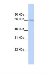 SLC22A6 / OAT1 Antibody - Fetal lung lysate. Antibody concentration: 1.0 ug/ml. Gel concentration: 12%.  This image was taken for the unconjugated form of this product. Other forms have not been tested.