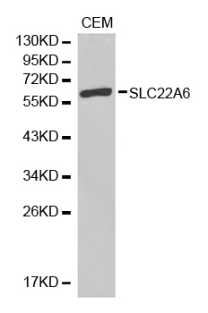 SLC22A6 / OAT1 Antibody - Western blot analysis of extracts of CEM cell lines, using SLC22A6 antibody.