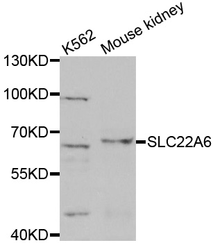 SLC22A6 / OAT1 Antibody - Western blot analysis of extracts of various cell lines, using SLC22A6 antibody.