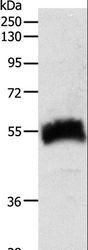 SLC22A6 / OAT1 Antibody - Western blot analysis of Human fetal kidney tissue, using SLC22A6 Polyclonal Antibody at dilution of 1:600.