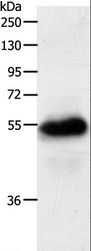 SLC22A6 / OAT1 Antibody - Western blot analysis of Human fetal kidney tissue, using SLC22A6 Polyclonal Antibody at dilution of 1:900.
