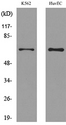 SLC22A6 / OAT1 Antibody - Western blot analysis of lysate from K562, HUVEC cells, using SLC22A6 Antibody.