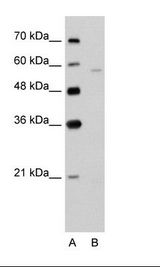 SLC22A7 / OAT2 Antibody - A: Marker, B: Jurkat Cell Lysate.  This image was taken for the unconjugated form of this product. Other forms have not been tested.