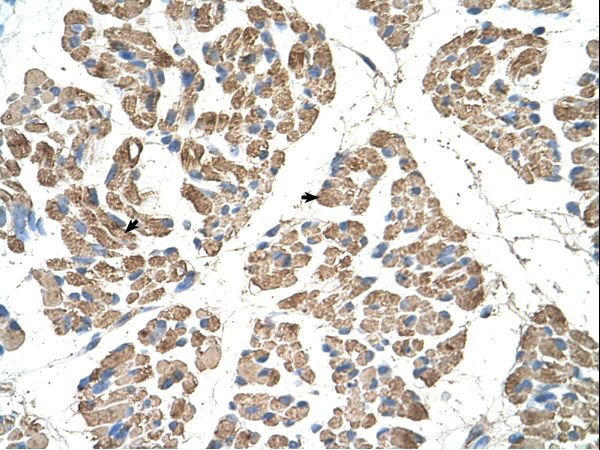 SLC22A7 / OAT2 Antibody - SLC22A7 antibody ARP42306_T100-NP_006663-SLC22A7(solute carrier family 22 (organic anion transporter), member 7) Antibody was used in IHC to stain formalin-fixed, paraffin-embedded human muscle.  This image was taken for the unconjugated form of this product. Other forms have not been tested.