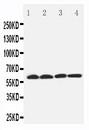 SLC22A7 / OAT2 Antibody - WB of SLC22A7 / OAT2 antibody. Lane 1: Rat Liver Tissue Lysate. Lane 2: Human Placenta Tissue Lysate. Lane 3: 293T Cell Lysate. Lane 4: SMMC Cell Lysate.
