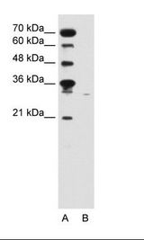 SLC22A7 / OAT2 Antibody - A: Marker, B: Jurkat Cell Lysate.  This image was taken for the unconjugated form of this product. Other forms have not been tested.