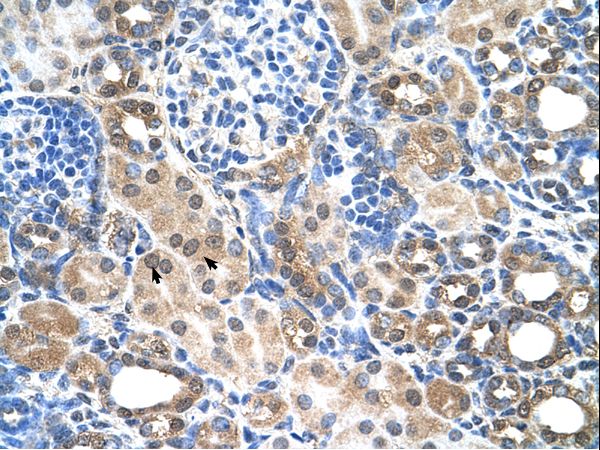 SLC22A7 / OAT2 Antibody - SLC22A7 antibody ARP42708_P050-NP_696961-SLC22A7(solute carrier family 22 (organic anion transporter), member 7) Antibody was used in IHC to stain formalin-fixed, paraffin-embedded human kidney.  This image was taken for the unconjugated form of this product. Other forms have not been tested.