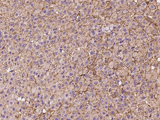 SLC22A7 / OAT2 Antibody - Immunochemical staining of human SLC22A7 in human liver with rabbit polyclonal antibody at 1:100 dilution, formalin-fixed paraffin embedded sections.
