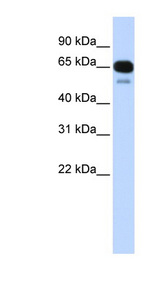 SLC22A8 / OAT3 Antibody - SLC22A8 antibody Western blot of Fetal Heart lysate. This image was taken for the unconjugated form of this product. Other forms have not been tested.