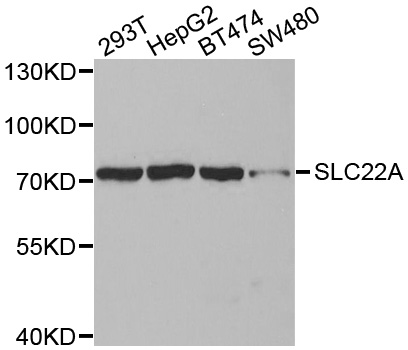 SLC22A8 / OAT3 Antibody - Western blot analysis of extracts of various cell lines, using SLC22A8antibody.