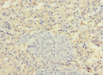 SLC22A8 / OAT3 Antibody - Immunohistochemistry of paraffin-embedded human adrenal gland tissue at dilution 1:100