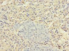 SLC22A8 / OAT3 Antibody - Immunohistochemistry of paraffin-embedded human adrenal gland tissue at dilution 1:100